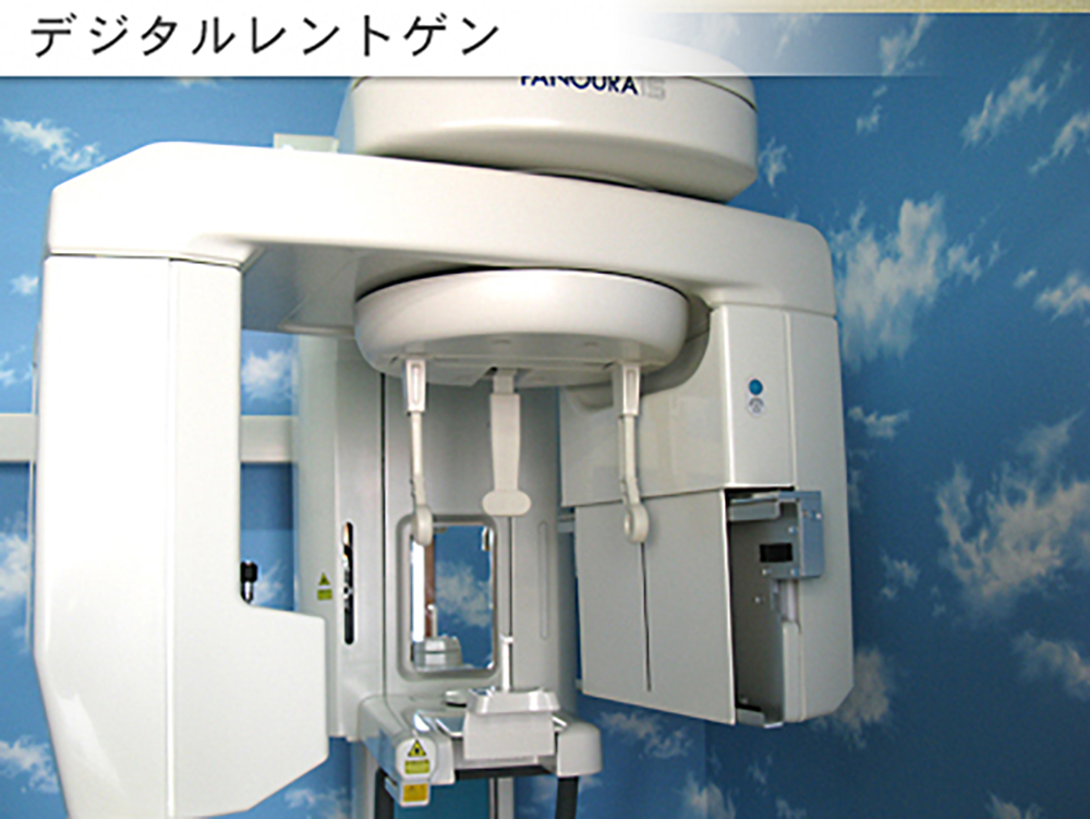 デジタルレントゲン
